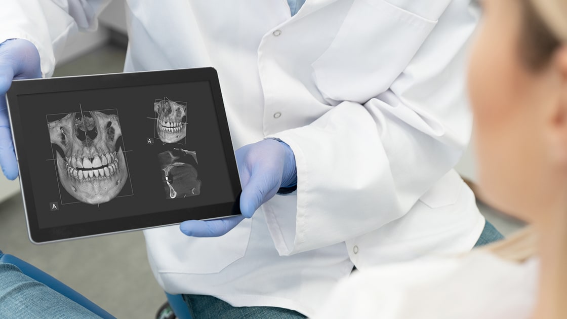 Endodontics Root Canal Photo